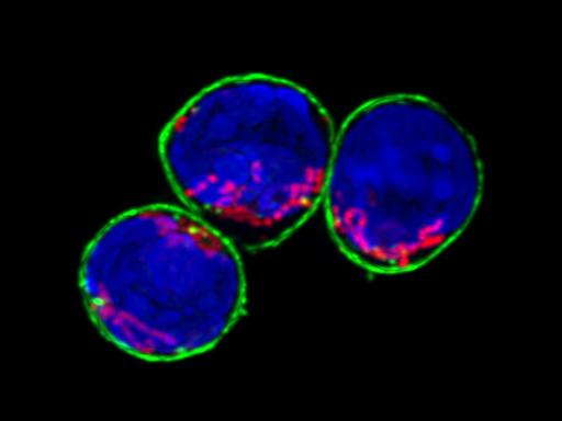 Distinguishing helpful and harmful gut immune cells offers new view on inflammatory diseases
